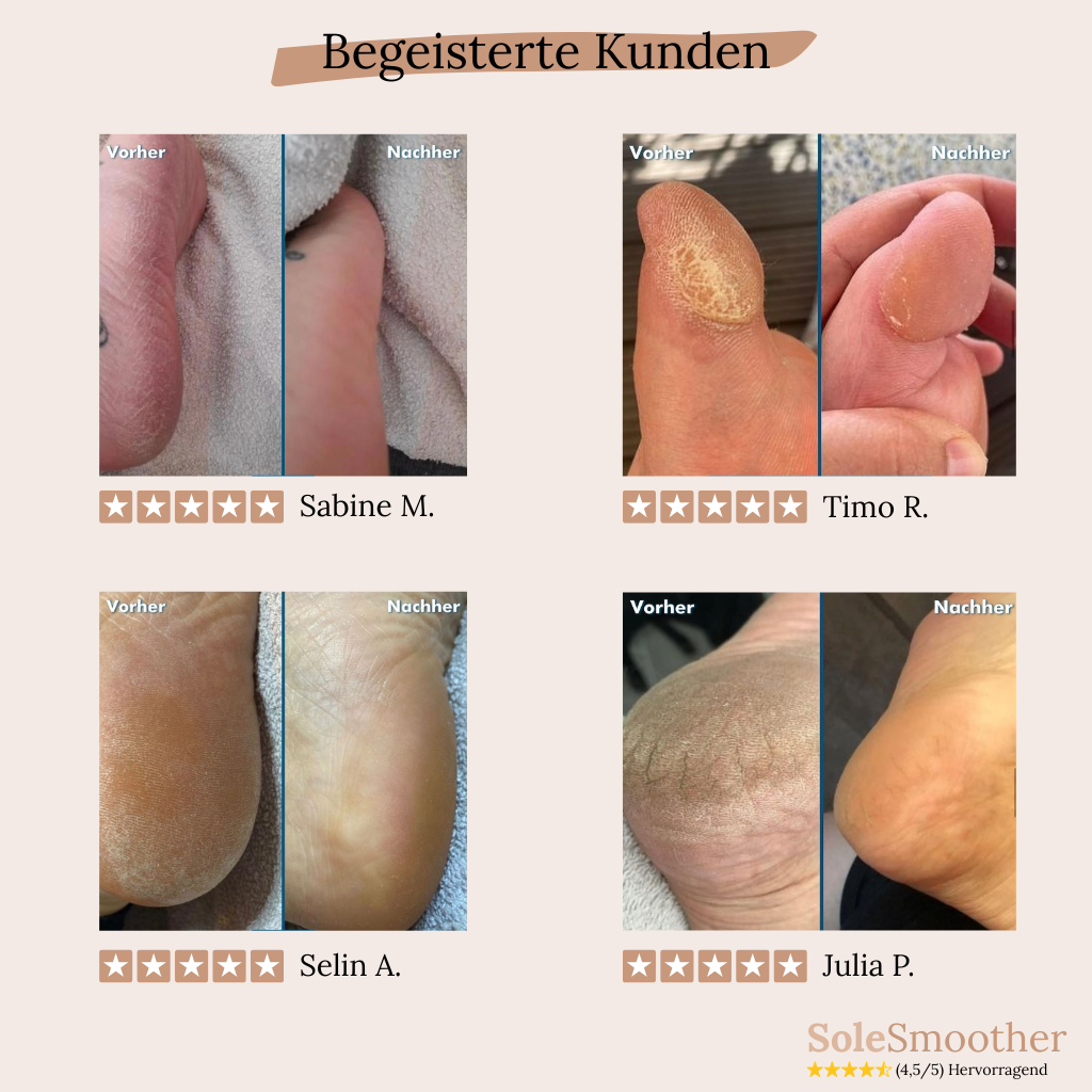 SoleSmoother – Für glatte, weiche Füße in Minuten.
