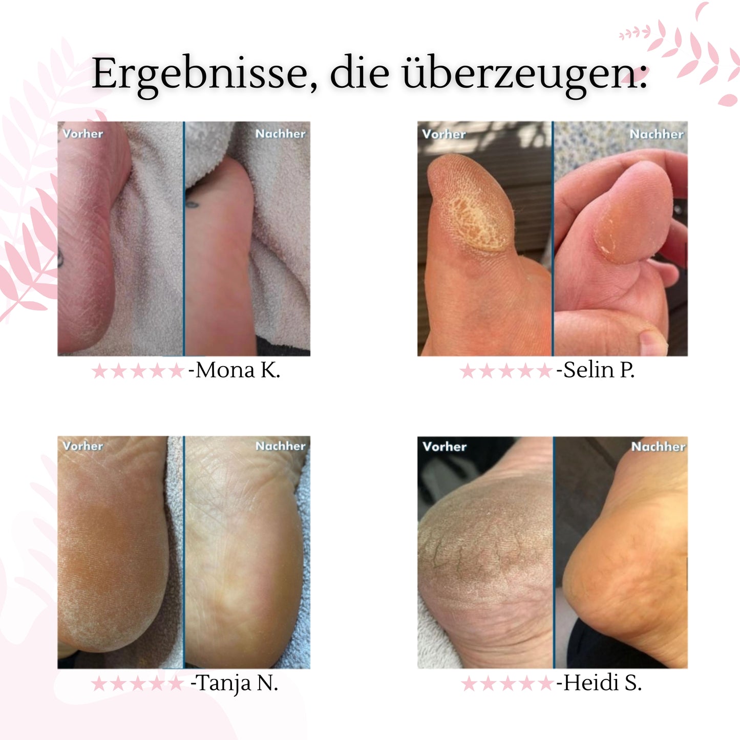 SoleSmoother – der 2-in-1 Profi-Hornhautentferner für glatte Füße in Minuten