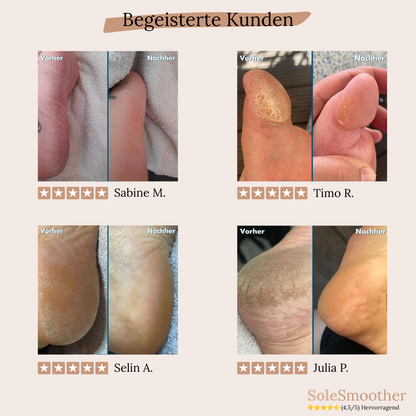 SoleSmoother – Für glatte, weiche Füße in Minuten.